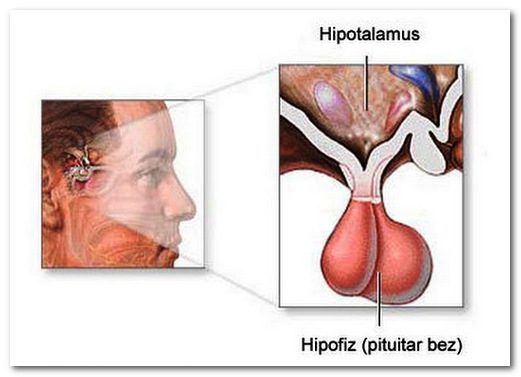 Синдром гиперпролактинемии: симптомы у мужчин и женщин